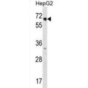 Nuclear Receptor Subfamily 2 Group C Member 1 (NR2C1) Antibody