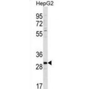 Palmitoyltransferase ZDHHC3 (ZDHC3) Antibody