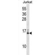 HIST1H2BB / HIST1H2BE Antibody