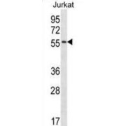 Complement C1r Subcomponent Like (C1RL) Antibody