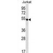 WD Repeat-Containing Protein 40A (WDR40A) Antibody