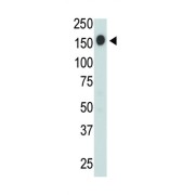 Western Blot analysis of jurkat cell lysate using CD45 Polyclonal Antibody.