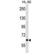 Ankyrin Repeat And KH Domain-Containing Protein 1 (ANKHD1) Antibody