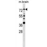 abx028672