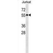 Mitogen-Activated Protein Kinase 14 (MAPK14) Antibody