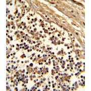 Myeloid Cell Surface Antigen CD33 (CD33) Antibody