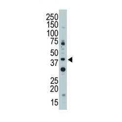 Myeloid Cell Surface Antigen CD33 (CD33) Antibody