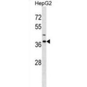 Immunoglobulin Binding Protein 1 (IGBP1) Antibody