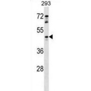 G Protein-Coupled Receptor 81 (GPR81) Antibody