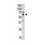 Sialic Acid Binding Ig Like Lectin 5 (SIGLEC5) Antibody