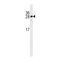 Krueppel-Like Factor 9 (KLF9) Antibody