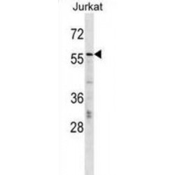 Protein CBFA2T2 (CBFA2T2) Antibody