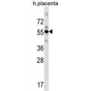 Zinc Finger And BTB Domain-Containing Protein 8B (ZBTB8B) Antibody