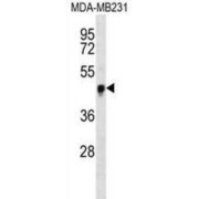 Transcriptional Coactivator YAP1 (YAP) Antibody