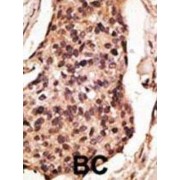abx028703