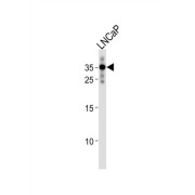 Ring Finger Protein 4 (RNF4) Antibody