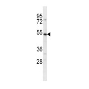 SLC39A14 Antibody