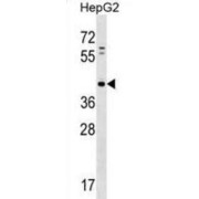 Phosphatidic Acid Phosphatase Type 2d (PAP2D) Antibody