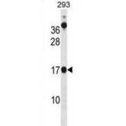 Coiled-Coil-Helix-Coiled-Coil-Helix Domain Containing 10 (CHCHD10) Antibody