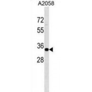 Zinc Finger Protein 570 (ZNF570) Antibody