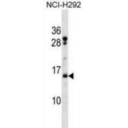 Histone H2B Type 2-F (HIST2H2BF) Antibody