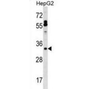 Surfactant Protein B (SFTPB) Antibody
