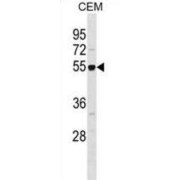 Histone-Binding Protein RBBP7 (RBBP7) Antibody