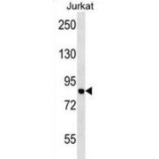 Minichromosome Maintenance Deficient 7 (MCM7) Antibody