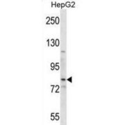 Smoothened Homolog (SMO) Antibody
