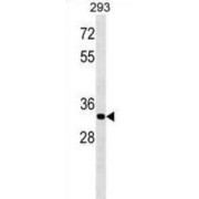 ELOVL Fatty Acid Elongase 4 (ELOVL4) Antibody