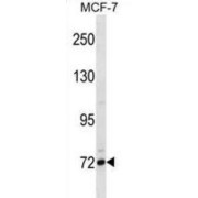 Fc Receptor-Like Protein 5 (FCRL5) Antibody