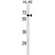 Absent In Melanoma 1-Like Protein (AIM1L) Antibody