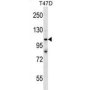 Apoptosis-Stimulating of p53 Protein 2 (TP53BP2) Antibody