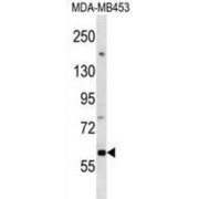 Death-Associated Protein Kinase 1 (Dapk1) Antibody