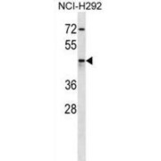 Aldo-Keto Reductase Family 1 Member C4 (AKR1C4) Antibody