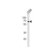 Zinc Finger Protein 90 (ZNF90) Antibody