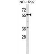 Zinc Finger Protein 512 (ZNF512) Antibody