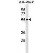 5-Hydroxytryptamine Receptor 7 (HTR7) Antibody