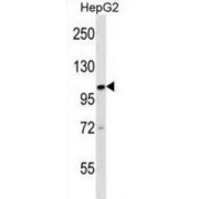 Kinesin Family Member 18A (KIF18A) Antibody
