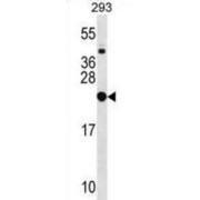 Ribosomal Protein L9 (RPL9) Antibody