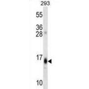 Regulator of G-Protein Signaling 8 (RGS8) Antibody