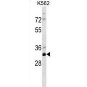 Western blot analysis of K562 cells using Ribose-Phosphate Pyrophosphokinase 2 (PRPS2) Antibody (35 µg/lane).