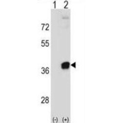 Ribose-Phosphate Pyrophosphokinase 2 (PRPS2) Antibody