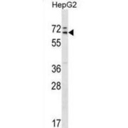 Mediator Complex Subunit 26 (MED26) Antibody