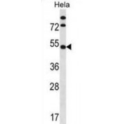 Inositol Hexakisphosphate Kinase 1 (IP6K1) Antibody