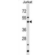 BAG Family Molecular Chaperone Regulator 5 (BAG5) Antibody