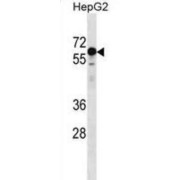 Kelch-Like Protein 25 (KLHL25) Antibody