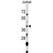 snRNA-Activating Protein Complex Subunit 1 (SNAPC1) Antibody