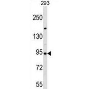 Semaphorin 3D (SEMA3D) Antibody