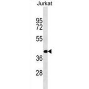 Suppressor of CDC2 With RNA-Binding Motif 3 (RBMS2) Antibody